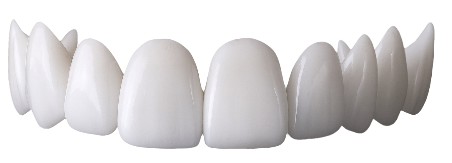 Shiny Smile Veneers 21