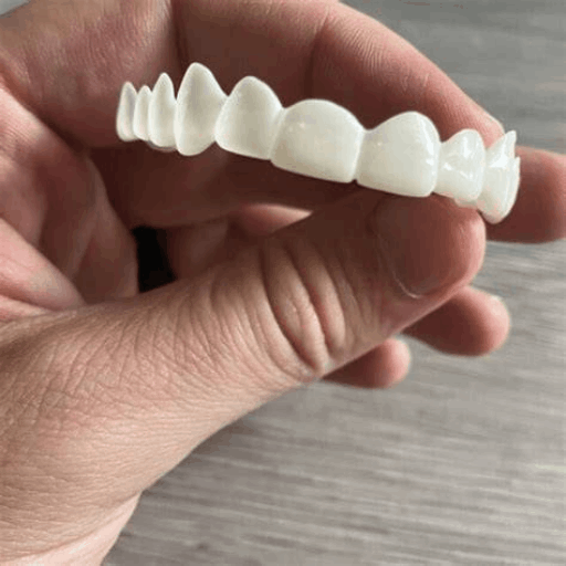 Shiny Smile Veneers 7