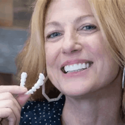 Shiny Smile Veneers 8